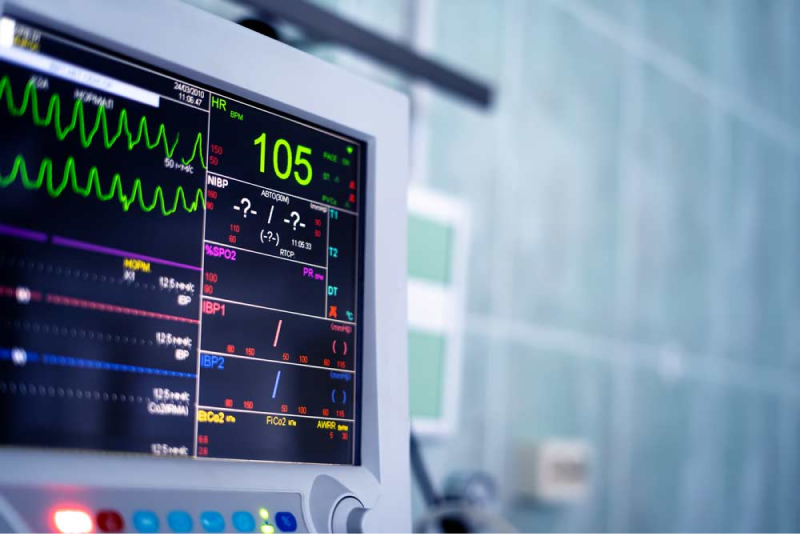 ECG