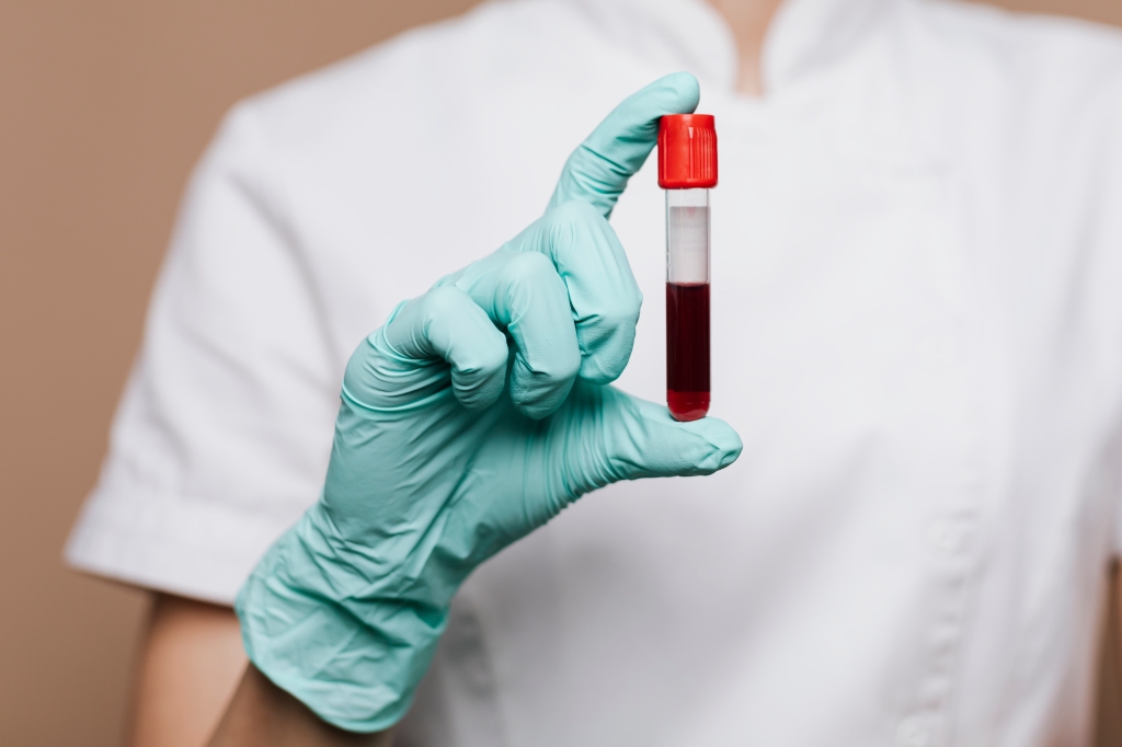 Blood / Urine test